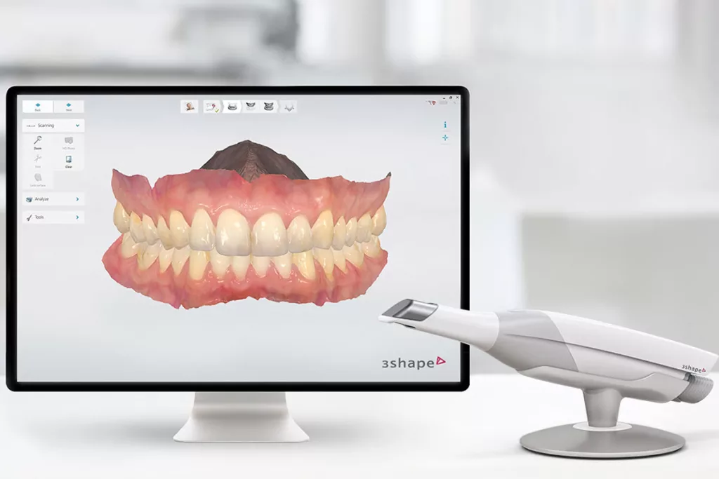 Hacer impresiones dentales en un abrir y cerrar de ojos con el escáner 3D Trios de 3shape
